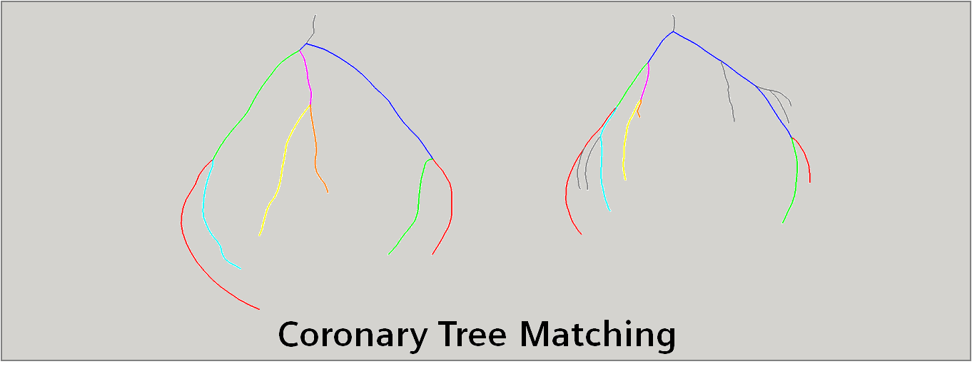 coronary_tree_matching2.png