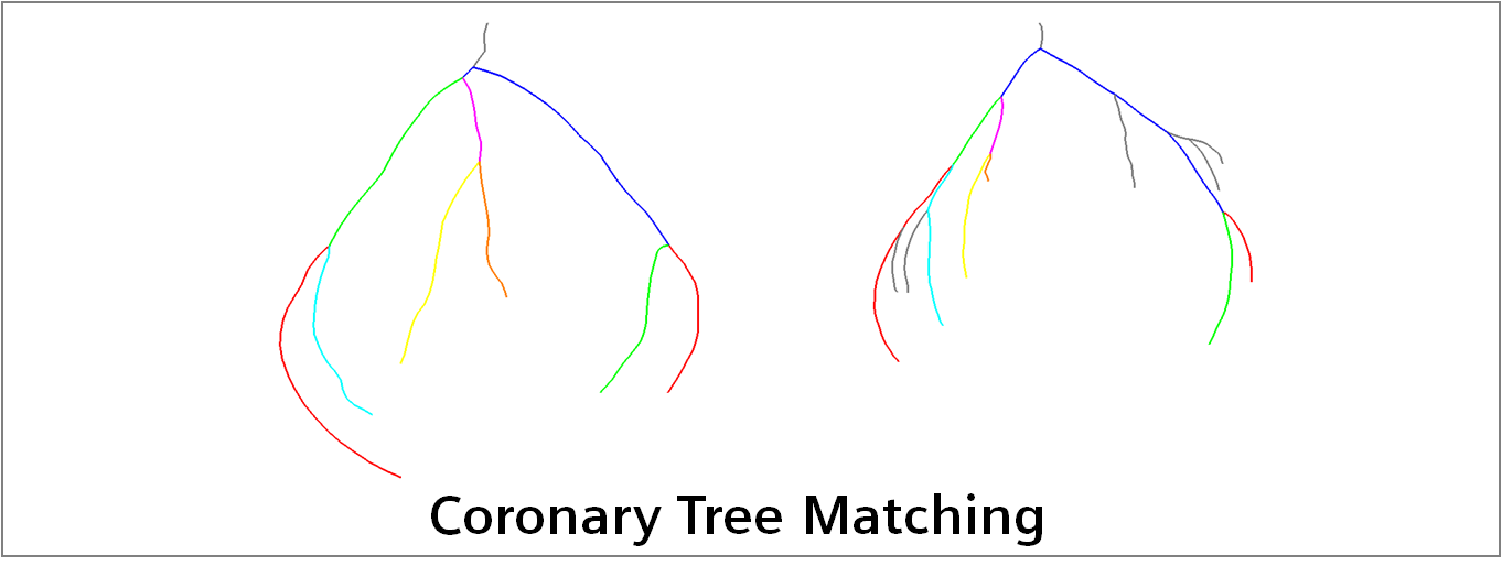 coronary_tree_matching.png