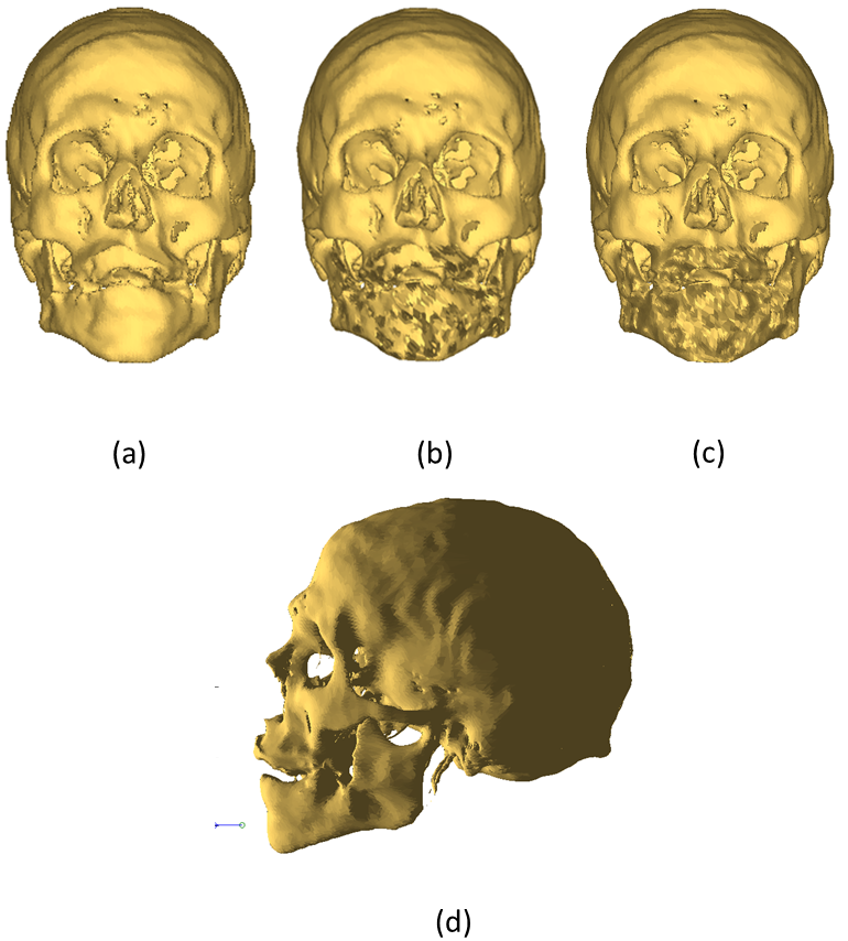 Figure 7: A synthetic disfigurement