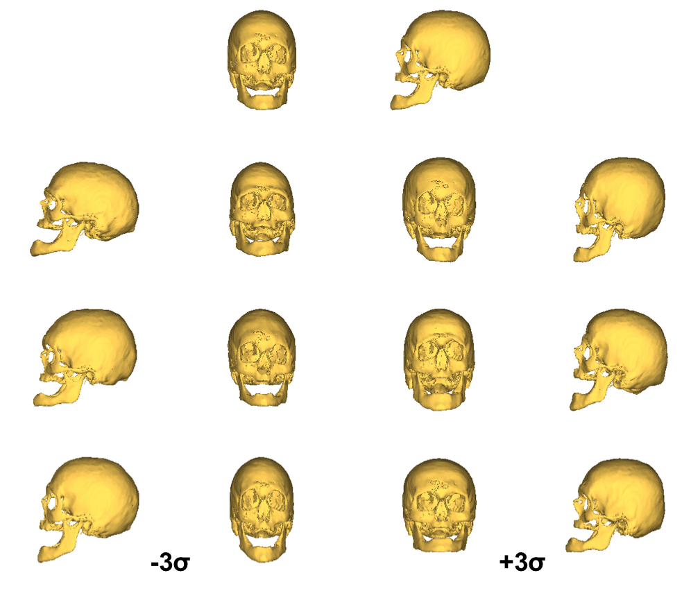 Figure 4: Mean Shape and Modes 1-3 of the Atlas