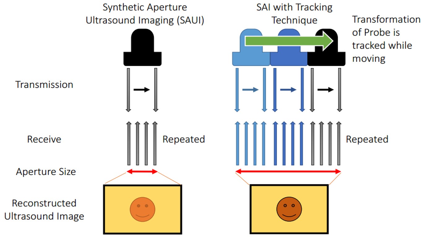 Ultrasound B-Mode Image Reconstruction 