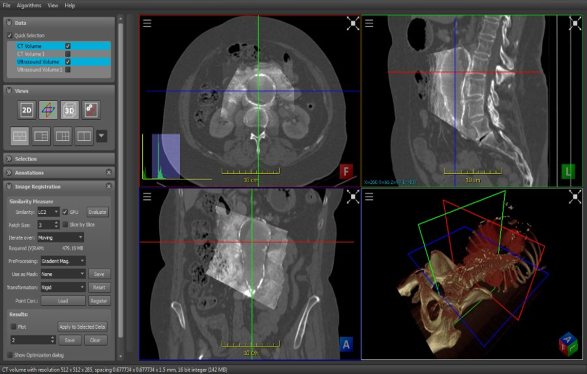 ImFusion user interface