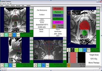 Screenshot of RadVision