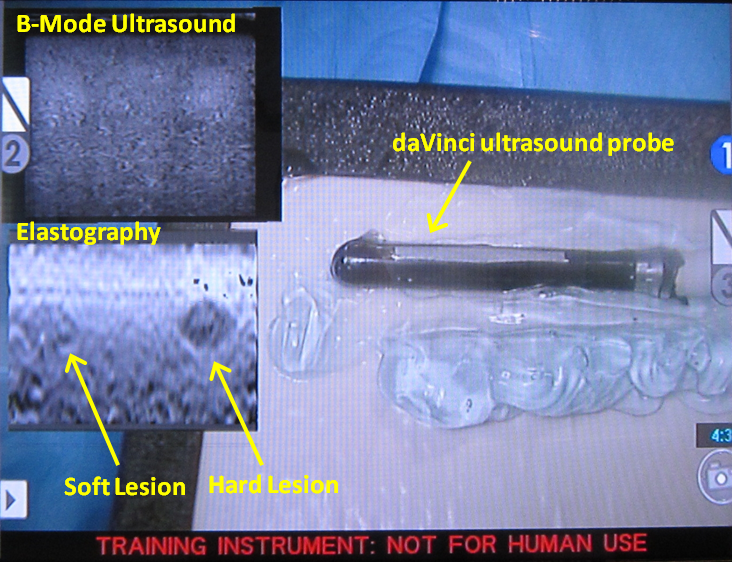 Elastography phantom being imaged by the RALUSE system