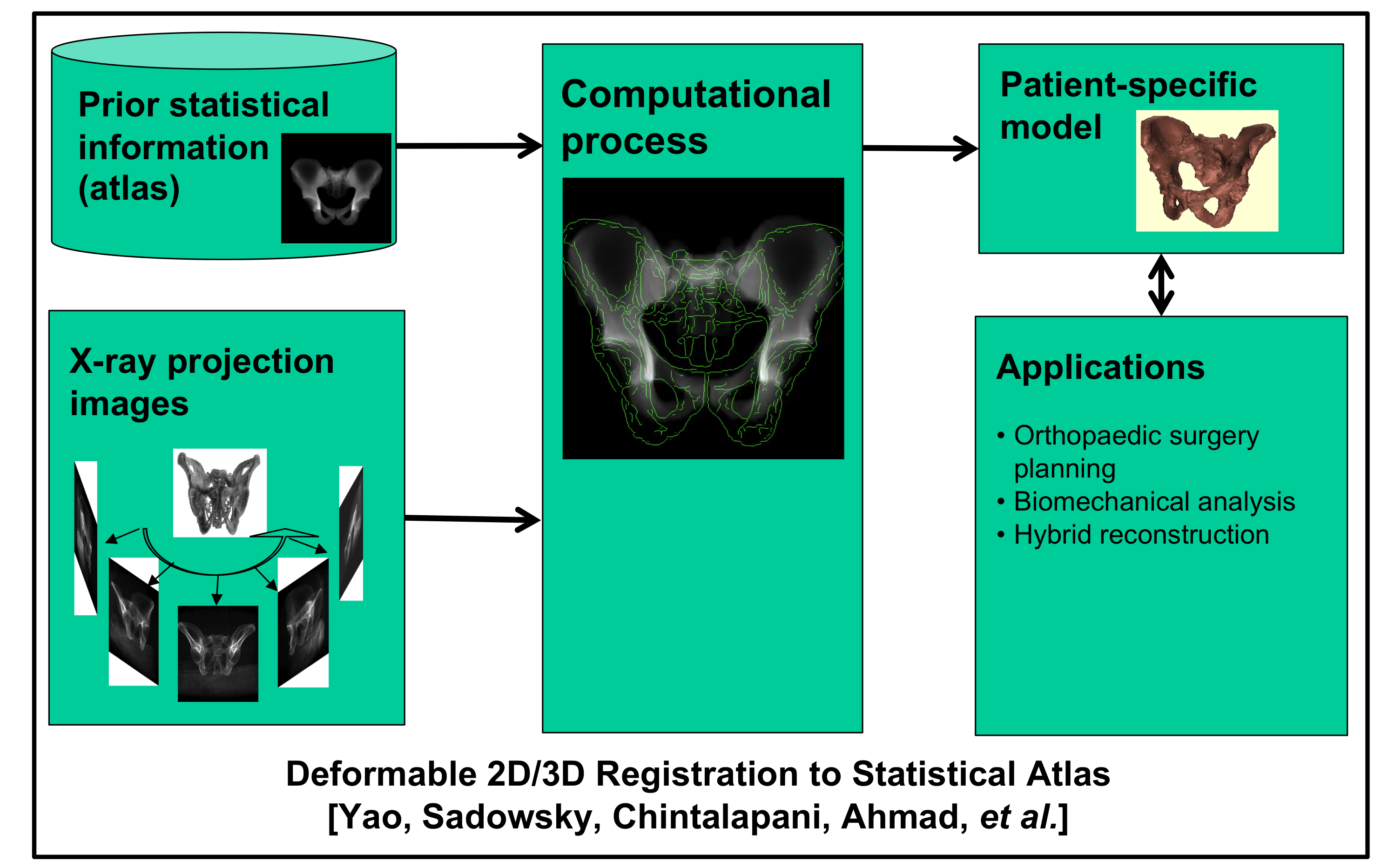 Deformable 2D-3D registration of statistical model of pelvis from sparse set of x-rays