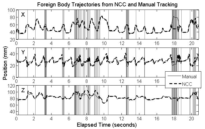 Figure 4. Motion traces of a foreign body in a beating heart phantom. Vertical lines correspond to rejected frames.